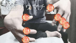 関節リウマチ