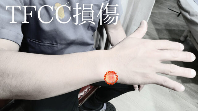 TFCC損傷について