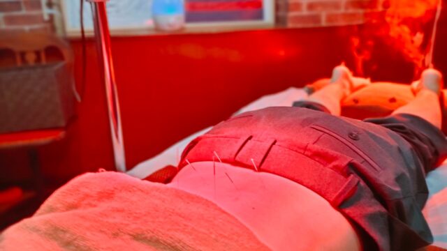 不眠改善　鍼灸&整体